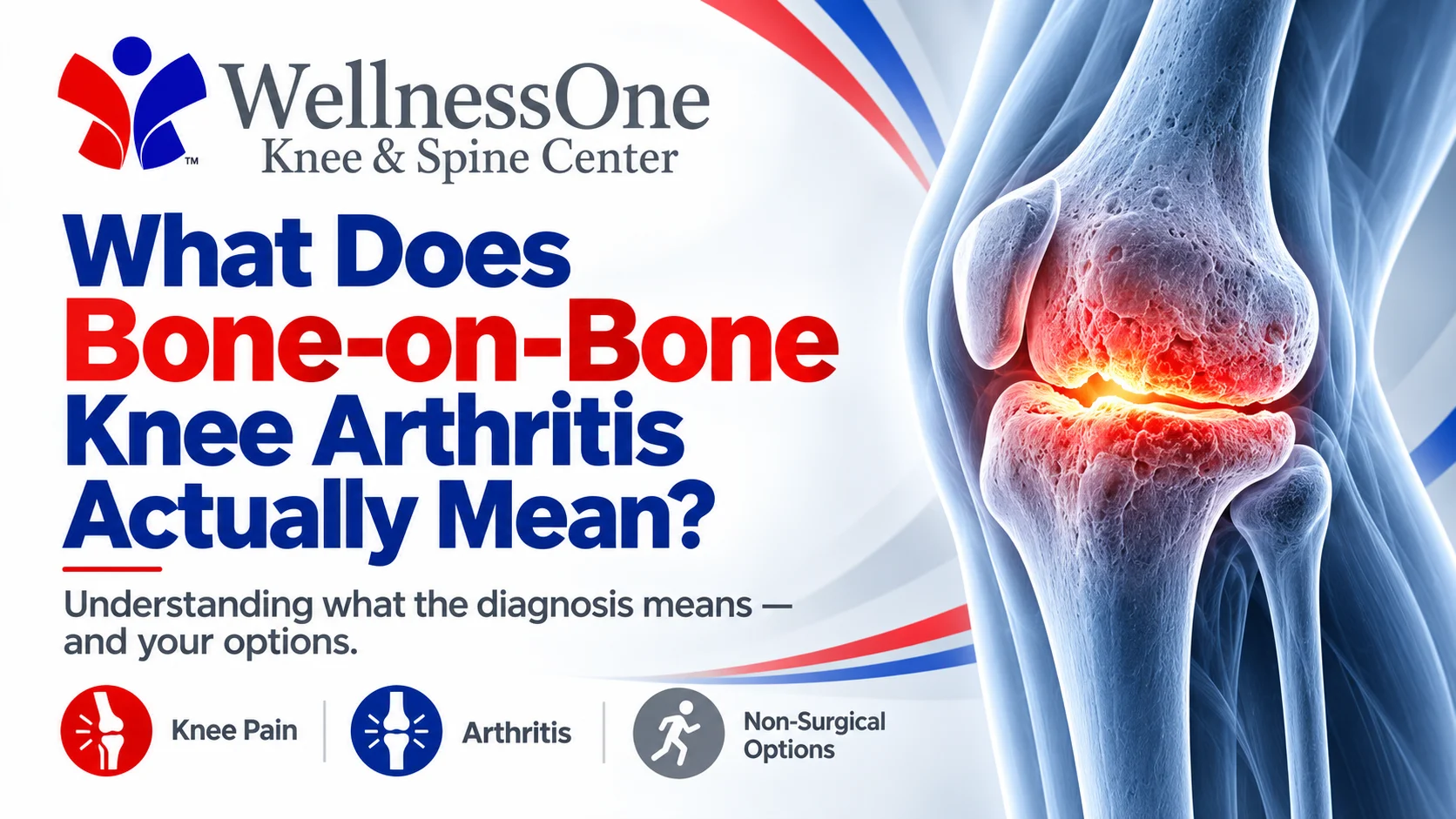 Knee arthritis evaluation at WellnessOne in Lincoln, NE